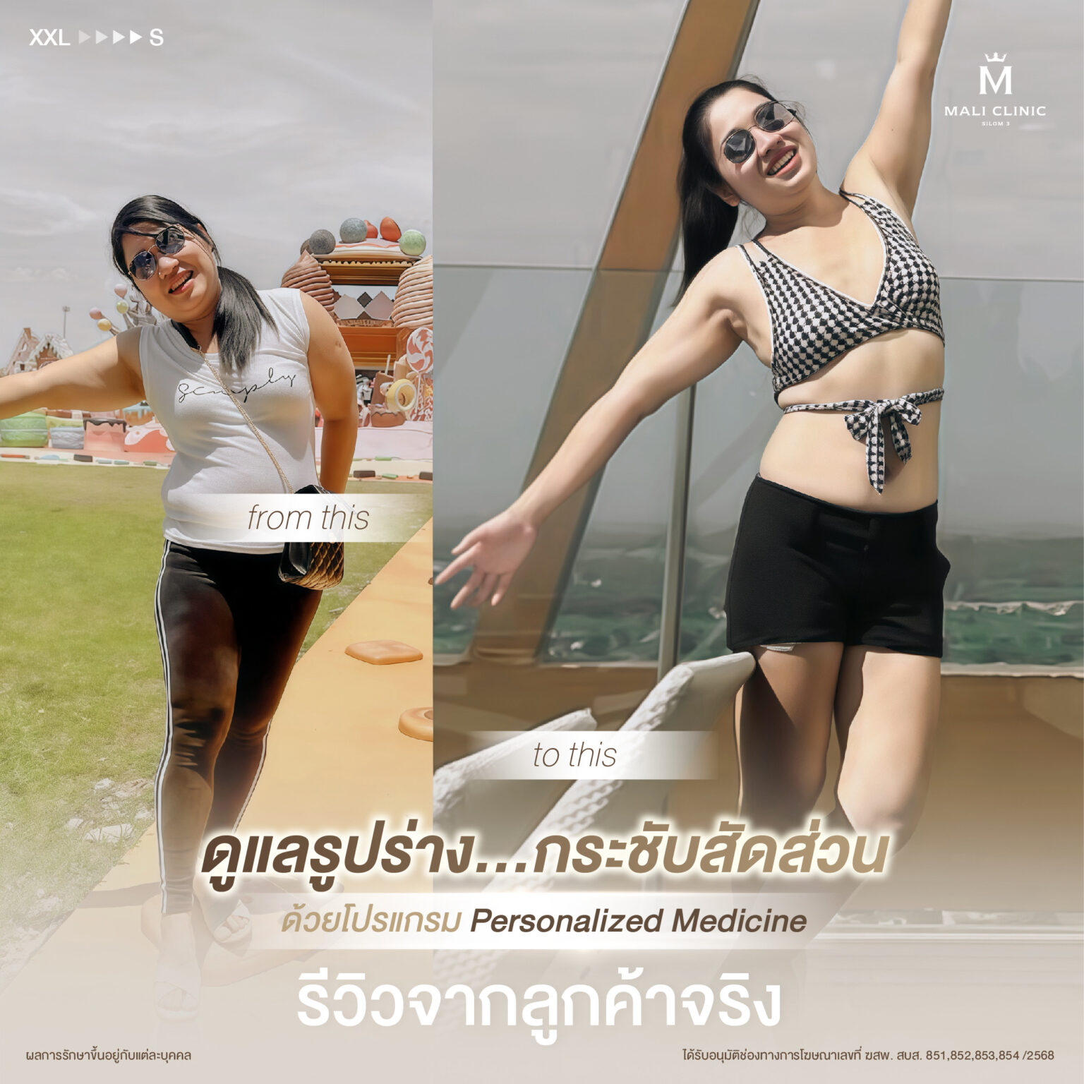 รีวิวการดูแลรูปร่าง