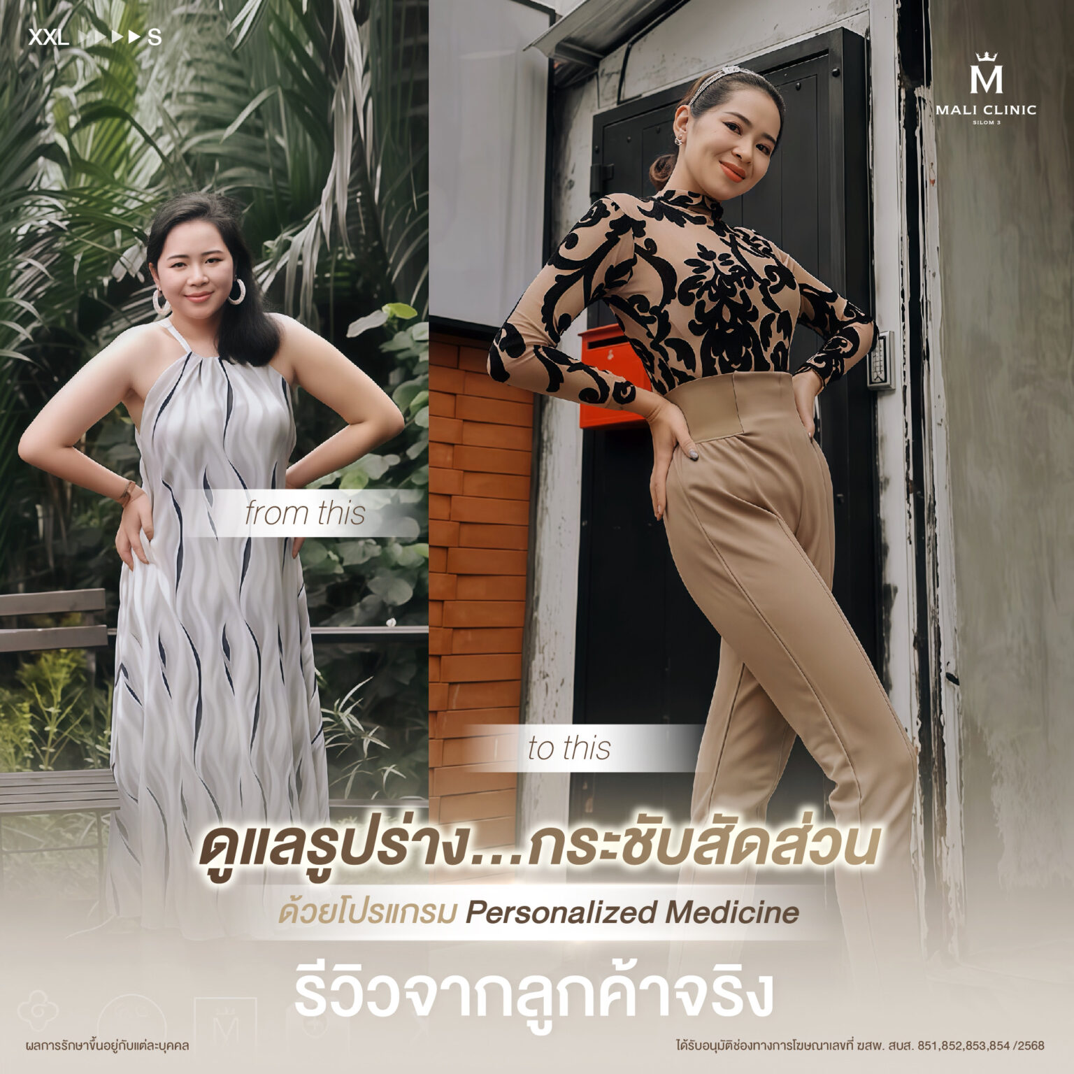 รีวิวการดูแลรูปร่าง