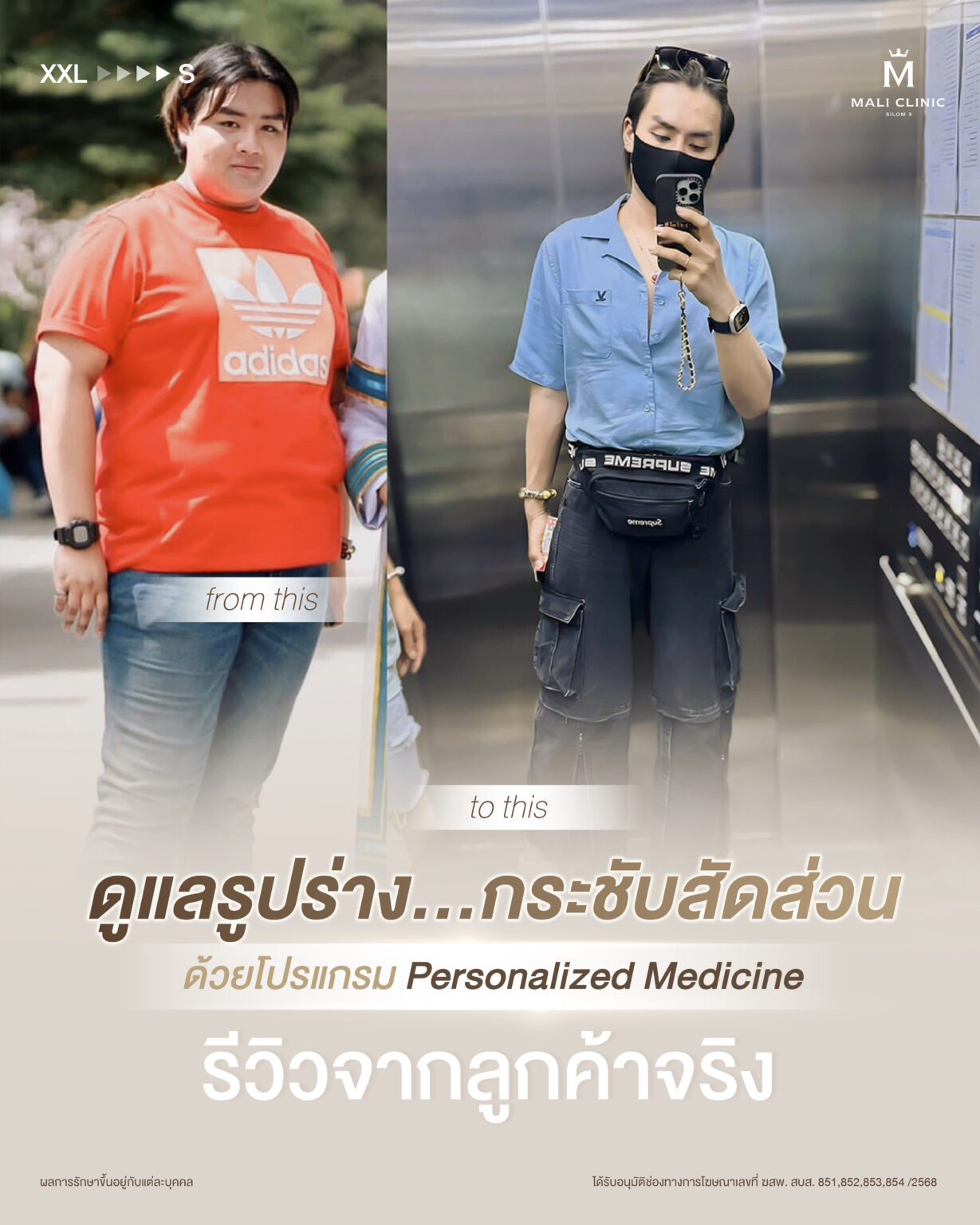 ปรับรูปร่างด้วยโปรแกรม Personalized Medicine
