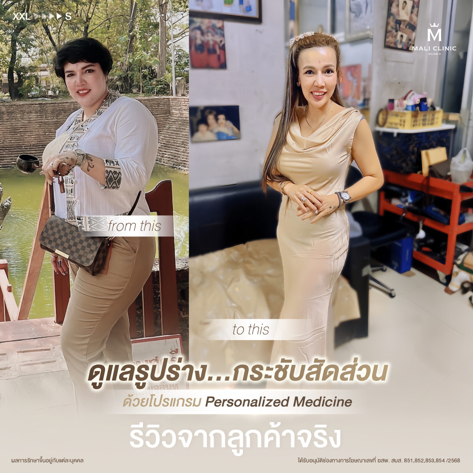 ดูแลรูปร่างกระชับสัดส่วน