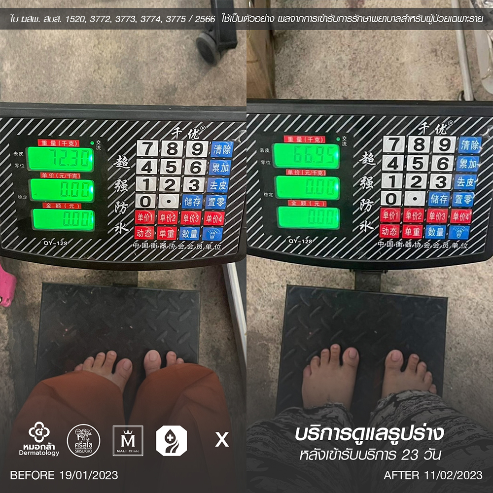 รีวิการเปลี่ยนแปลงการปรับรูปร่าง
