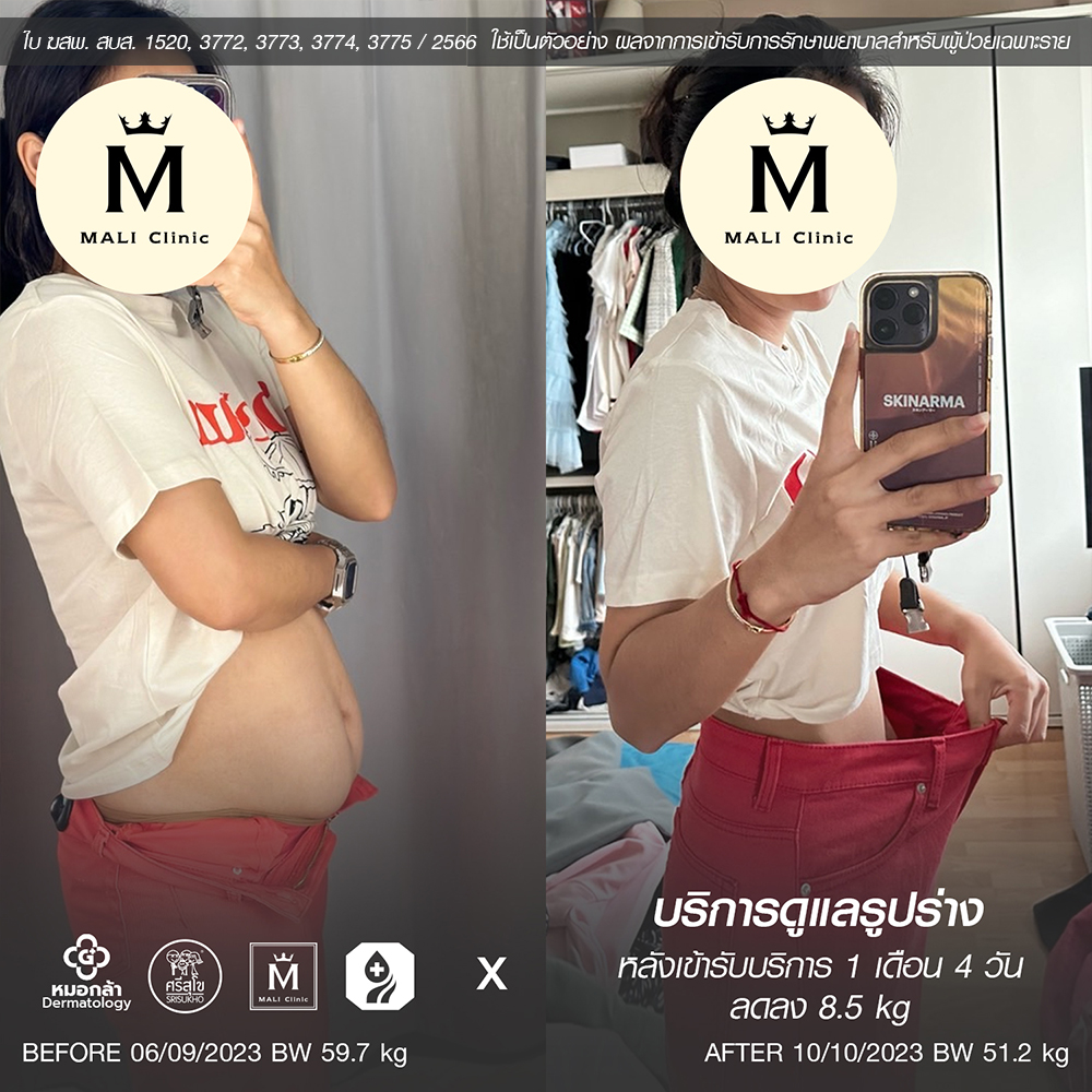 รีวิวบริการดูแลรูปร่าง
