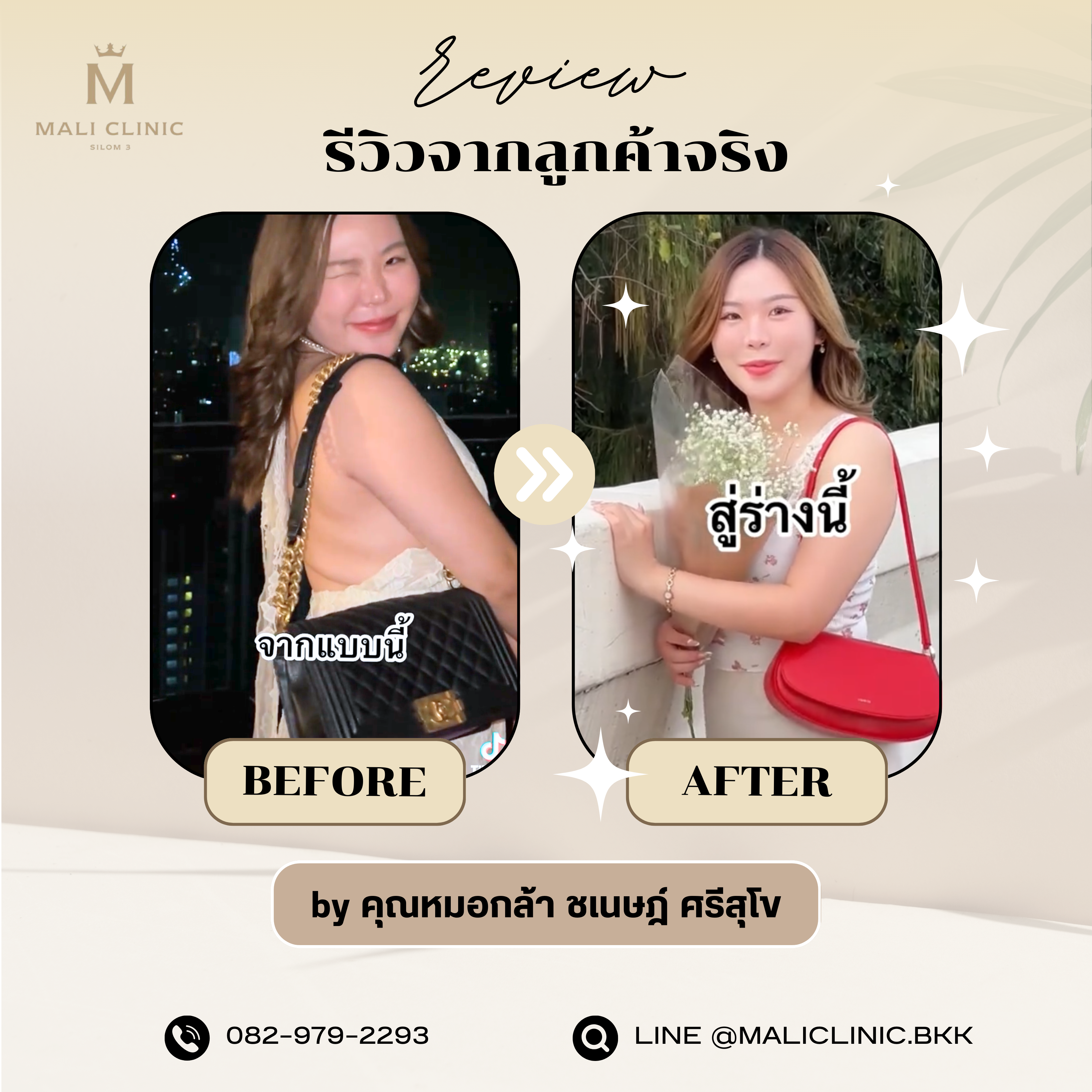 รีวิวปรับรูปร่างจากลูกค้าจริง