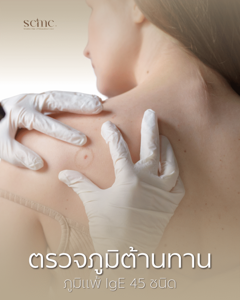 SCMC - ตรวจภูมิต้านทาน ภูมิแพ้ IgE 45 ชนิด​