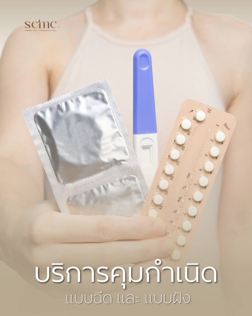 SCMC - บริการคุมกำเนิด แบบฉีด และ แบบฝัง (Contraception)