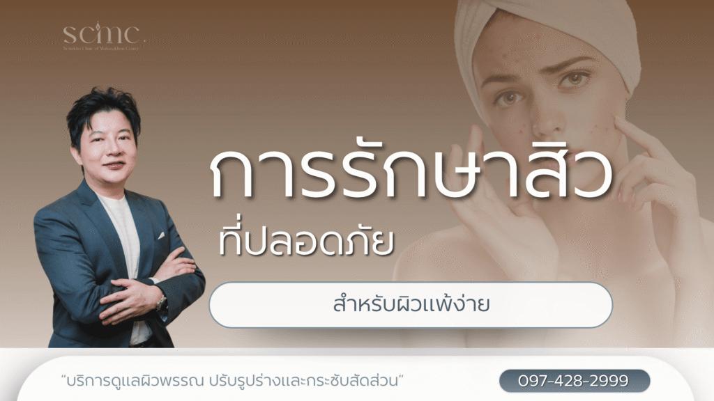 การรักษาสิวที่ปลอดภัยสำหรับผิวแพ้ง่าย