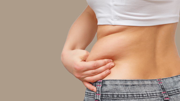 โรคอ้วน