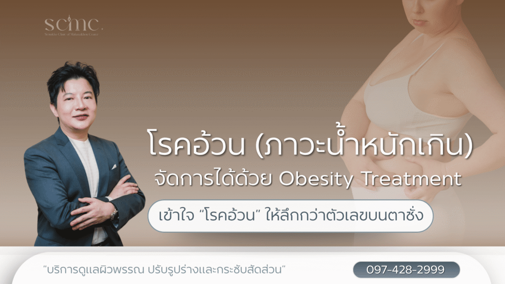 โรคอ้วน (ภาวะน้ำหนักเกิน) จัดการได้ด้วย Obesity Treatment
