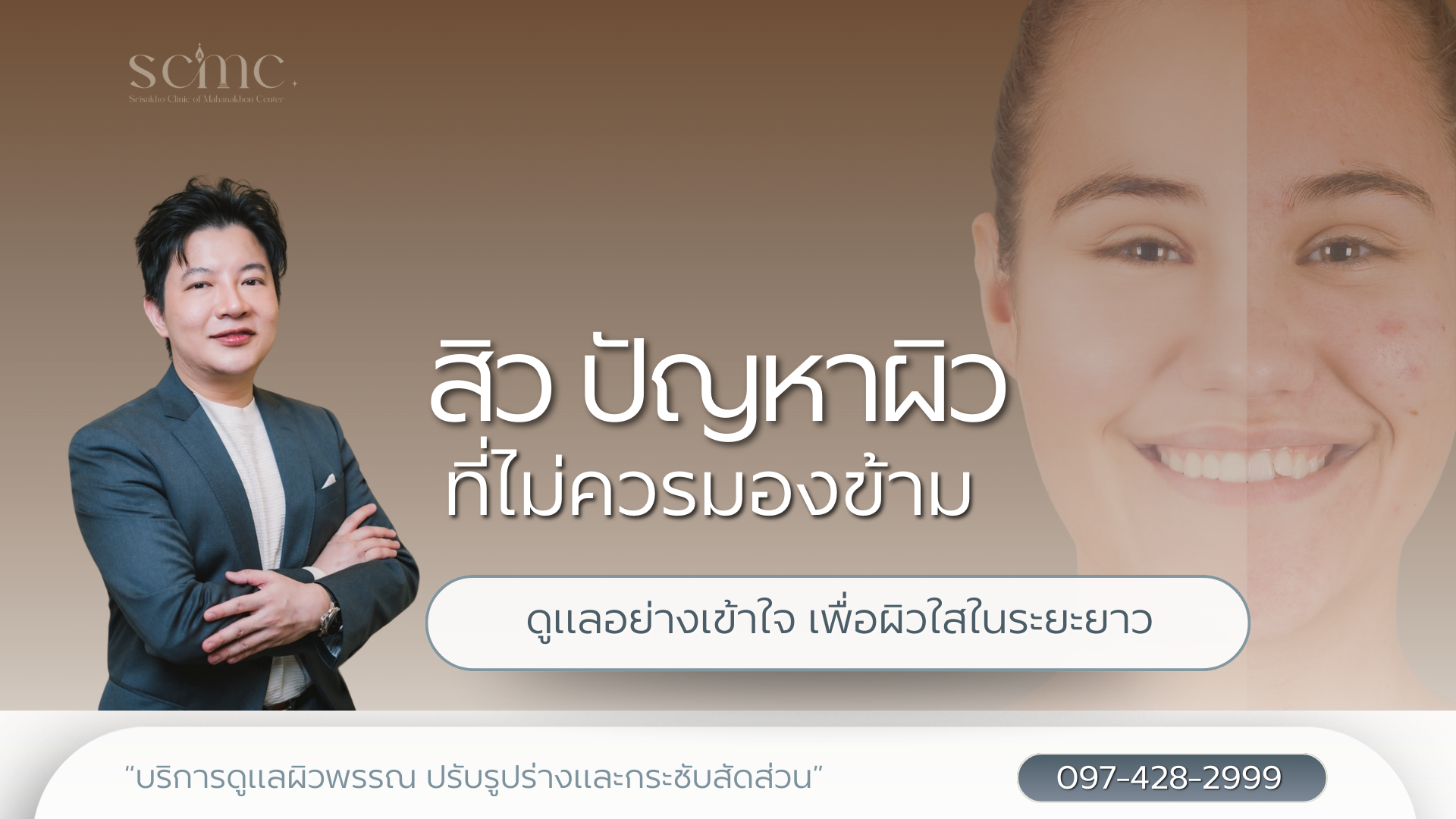 สิว ปัญหาผิวที่ไม่ควรมองข้าม ดูแลอย่างเข้าใจ เพื่อผิวใสในระยะยาว