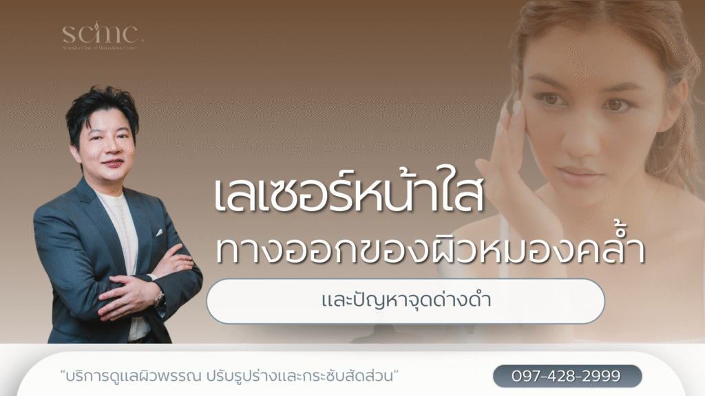 เลเซอร์หน้าใส ทางออกของผิวหมองคล้ำและปัญหาจุดด่างดำ