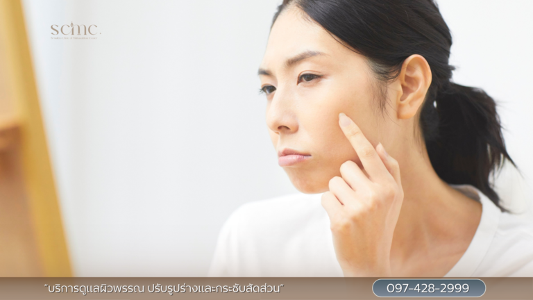 ผิวหย่อนคล้อย