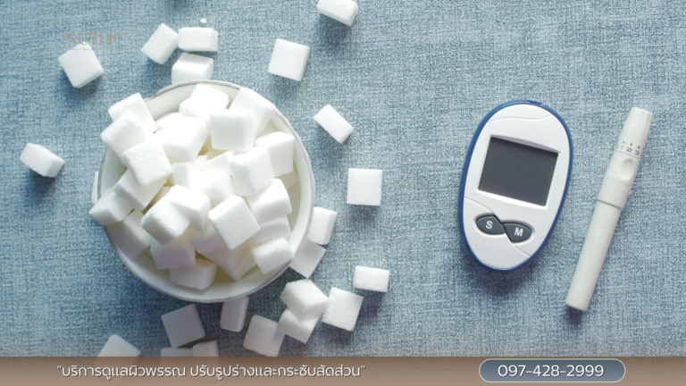 น้ำตาลในเลือด