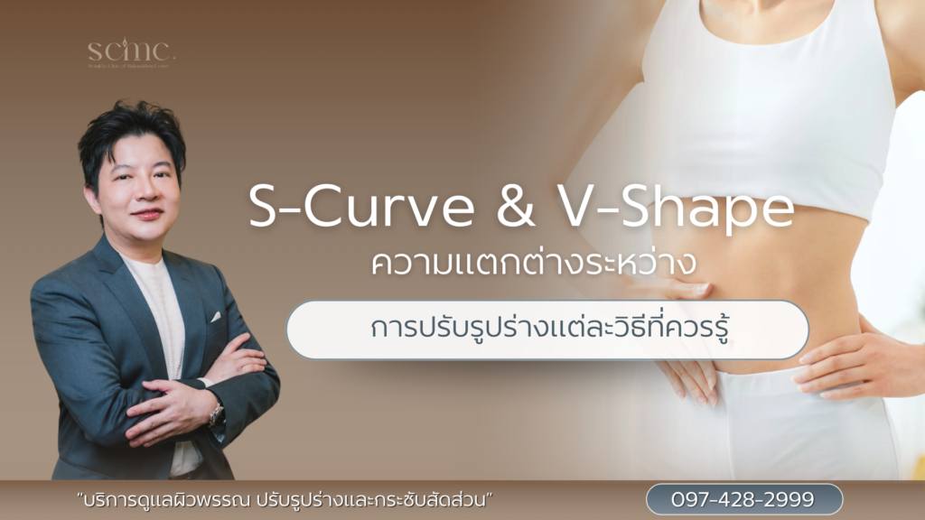 S-Curve & V-Shape