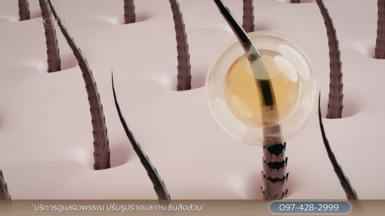 หนังศีรษะ สุขภาพดี